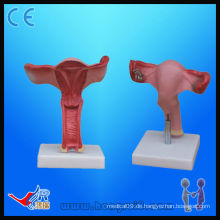 HR-436A Vergrößertes anatomisches Uterusmodell